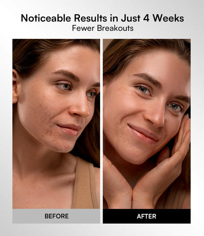 Red Light Therapy Mask for Face & Neck – 4 Light Modes with 850nm NIR, Red, Yellow & Blue LED Light Therapy, 2600mAh Rechargeable LED Face Mask for Anti-Aging, Skin Firming & Radiant Glow at Home