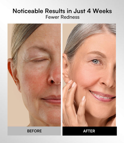 Red Light Therapy Mask for Face & Neck – 4 Light Modes with 850nm NIR, Red, Yellow & Blue LED Light Therapy, 2600mAh Rechargeable LED Face Mask for Anti-Aging, Skin Firming & Radiant Glow at Home