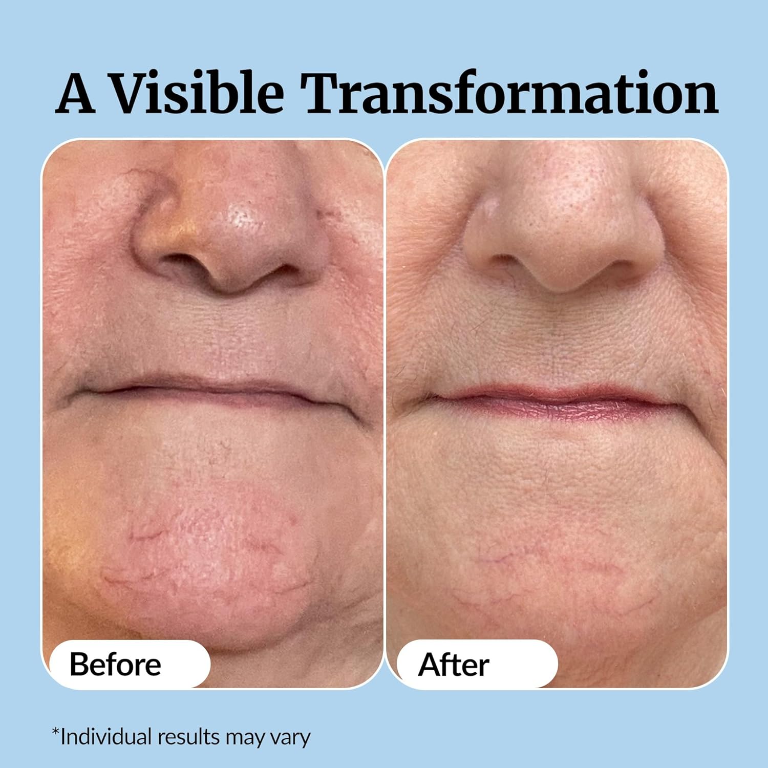 Vibriance Super C Serum for Mature Skin - All-in-One Vitamin Formula Hydrates, Firms, Lifts, Smooths, Targets Age Spots, Wrinkles, 1 fl oz - Pack of 3