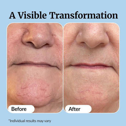 Vibriance Super C Serum for Mature Skin - All-in-One Vitamin Formula Hydrates, Firms, Lifts, Smooths, Targets Age Spots, Wrinkles, 1 fl oz - Pack of 3